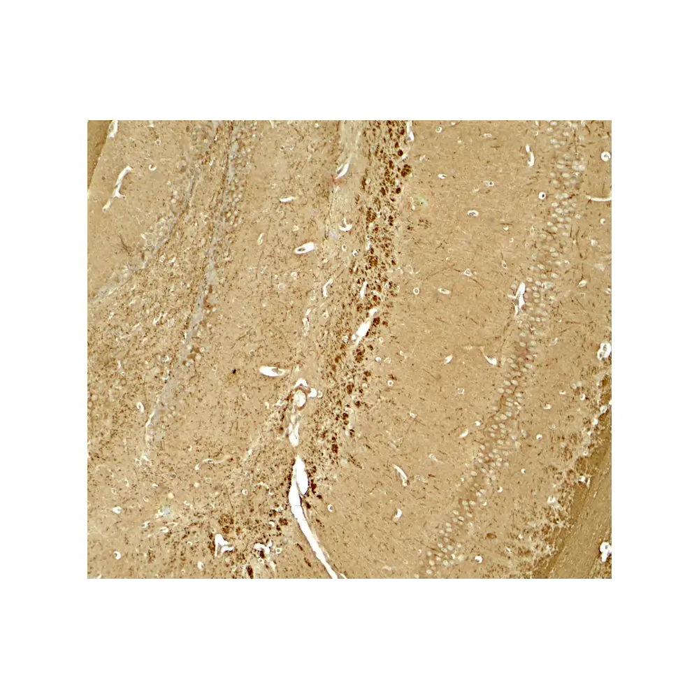 ProSci 7967 NINJ1 Antibody, ProSci, 0.1 mg/Unit Primary Image