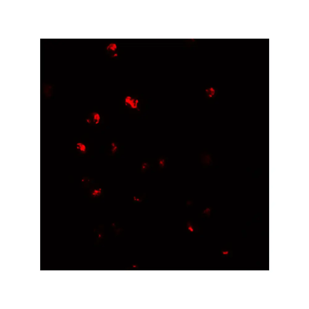 ProSci 5951 NOD4 Antibody, ProSci, 0.1 mg/Unit Tertiary Image