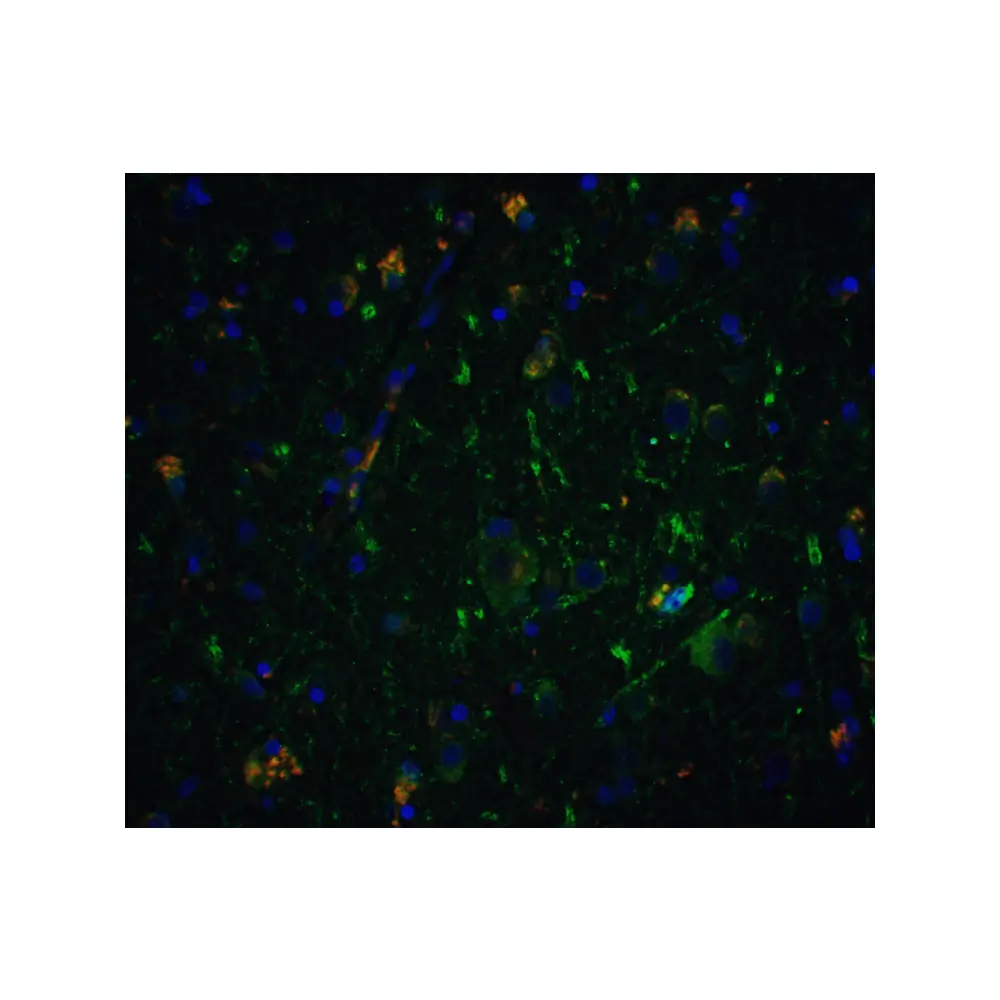 ProSci 1121_S Neurturin Antibody, ProSci, 0.02 mg/Unit Tertiary Image