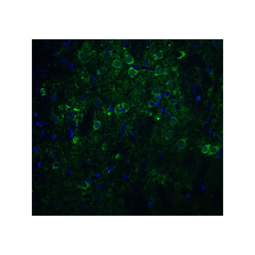 ProSci 3985_S Nicastrin Antibody, ProSci, 0.02 mg/Unit Quaternary Image