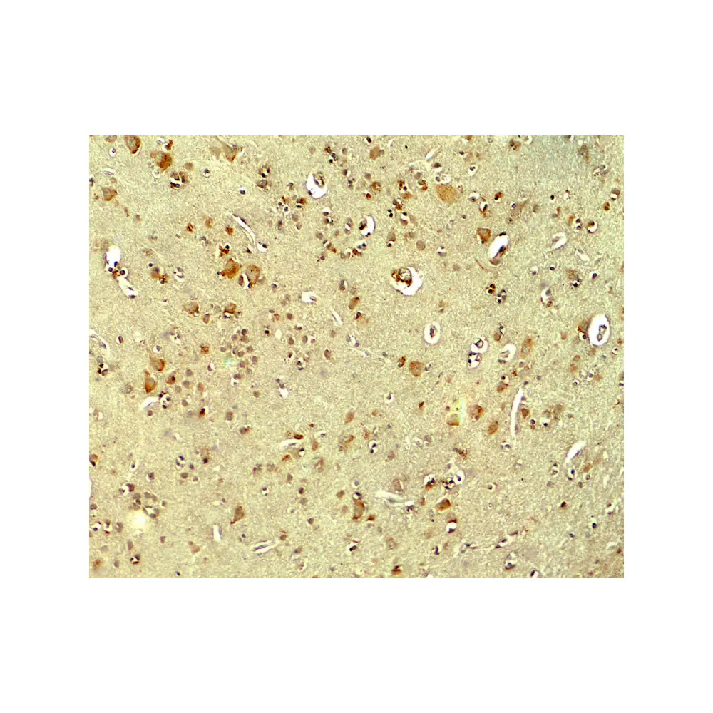 ProSci 7903 PARK2 Antibody, ProSci, 0.1 mg/Unit Secondary Image