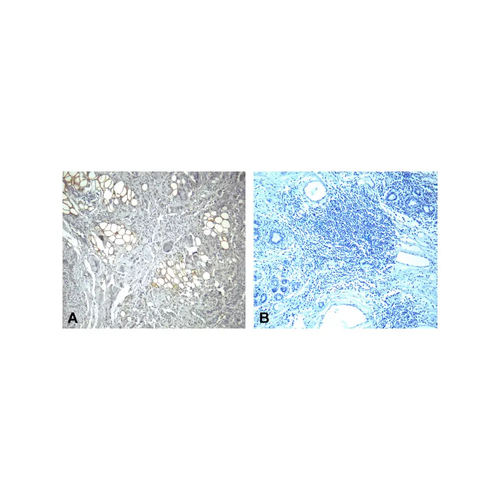 ProSci RF16004_S PD1 Antibody [4C7], ProSci, 0.02 mg/Unit Secondary Image