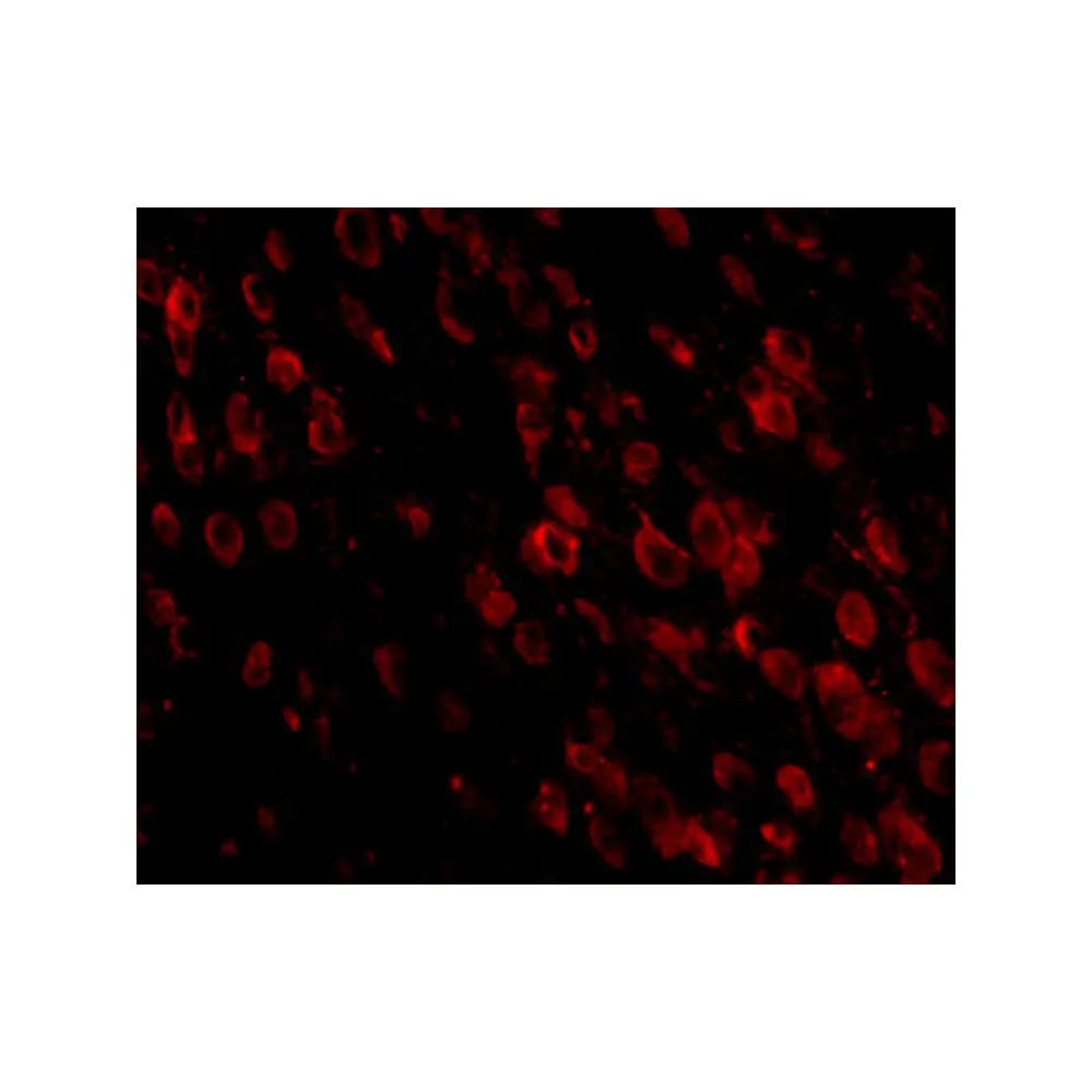 ProSci PM-5177_S PD-1 Antibody [7A11B1] , ProSci, 0.02 mg/Unit Tertiary Image