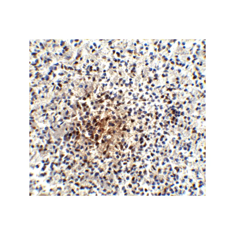 ProSci PM-5177_S PD-1 Antibody [7A11B1] , ProSci, 0.02 mg/Unit Quaternary Image