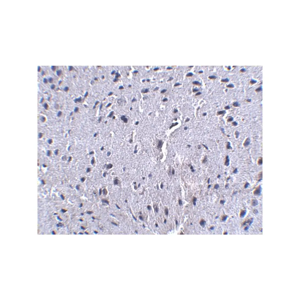 ProSci PM-5177_S PD-1 Antibody [7A11B1] , ProSci, 0.02 mg/Unit Secondary Image