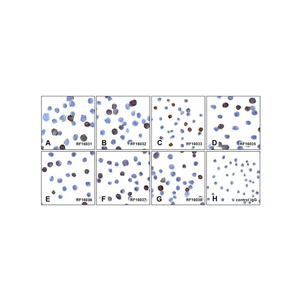 ProSci RF16030 PDL1 Detection Set (Risk Free), ProSci, 1 Set/Unit Tertiary Image