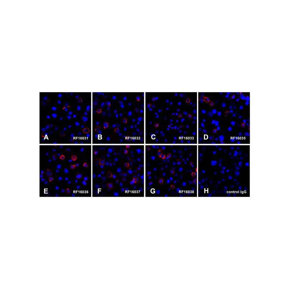 ProSci RF16030 PDL1 Detection Set (Risk Free), ProSci, 1 Set/Unit Quaternary Image