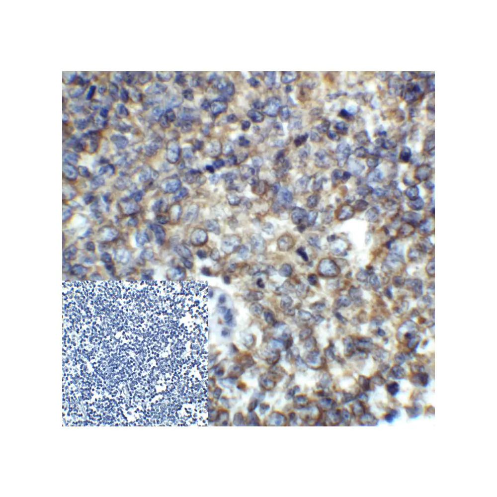 ProSci RF16006_S PD1 Antibody [5D3], ProSci, 0.02 mg/Unit Quaternary Image