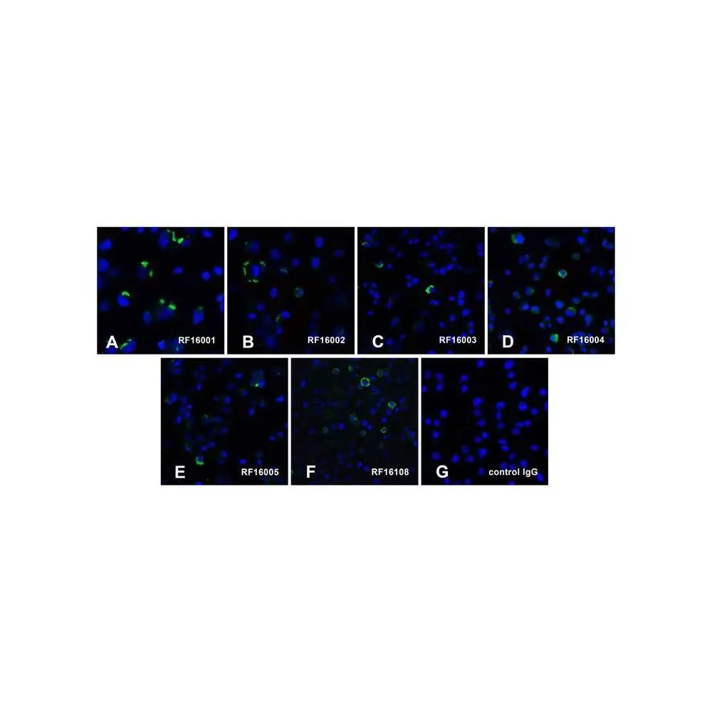 ProSci RF16000 PD1 Detection Set (Risk Free), ProSci, 1 Set/Unit Quaternary Image