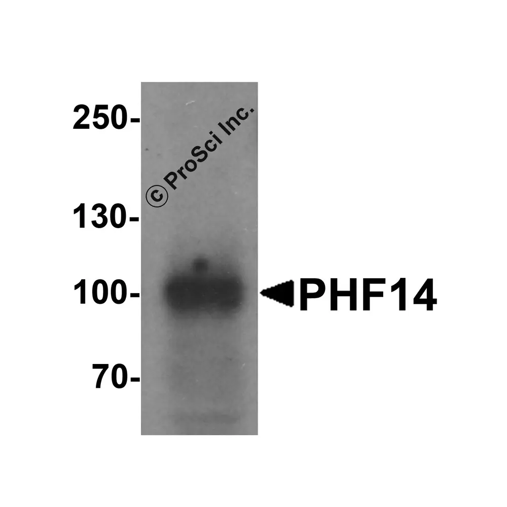 ProSci 7485_S PHF14 Antibody , ProSci, 0.02 mg/Unit Secondary Image