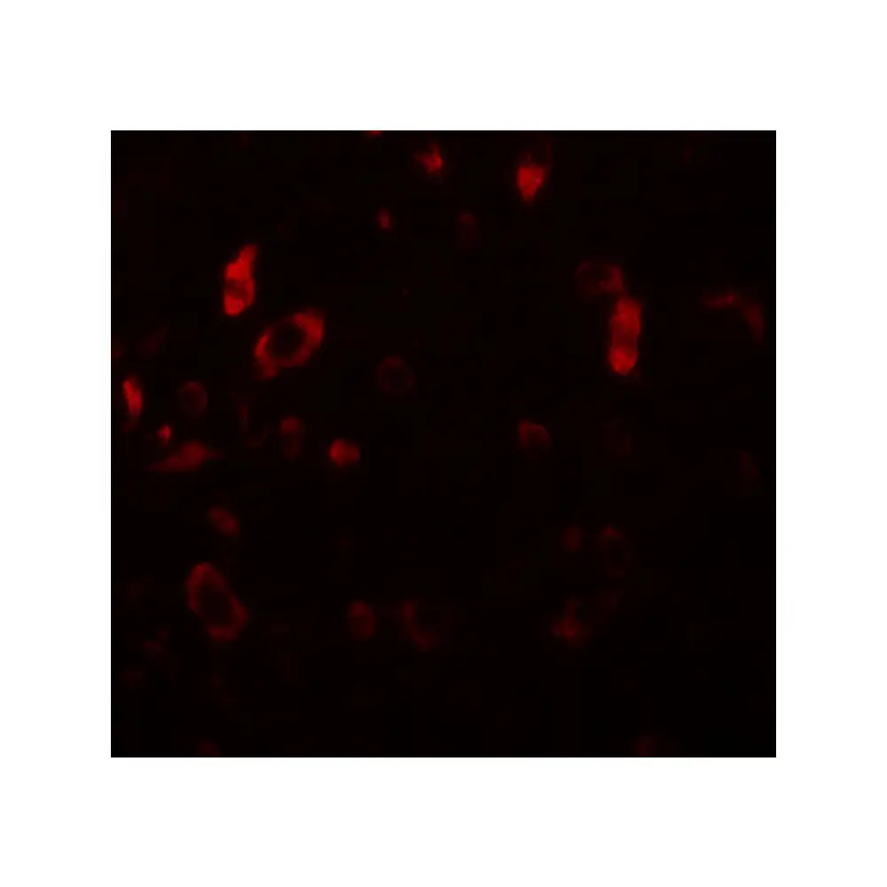 ProSci 5743_S PIAS2 Antibody, ProSci, 0.02 mg/Unit Tertiary Image