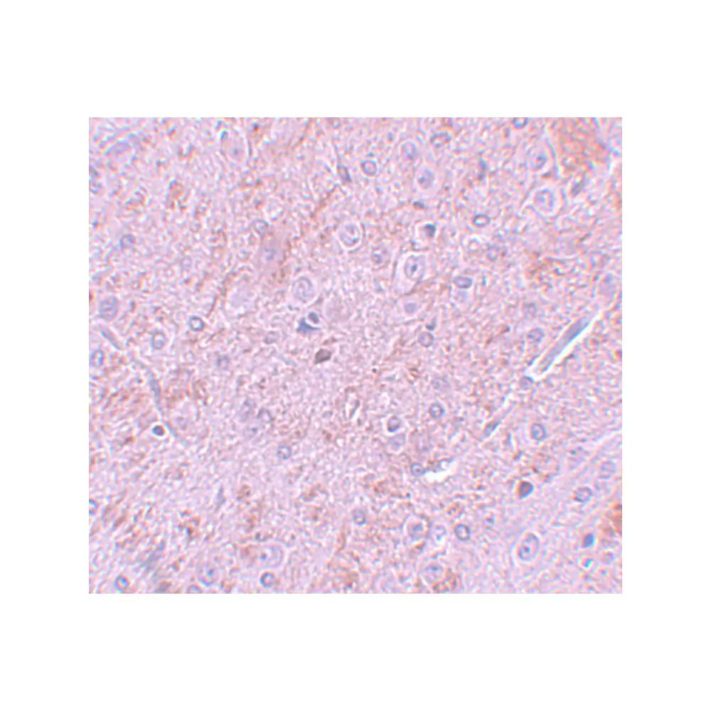 ProSci 5743_S PIAS2 Antibody, ProSci, 0.02 mg/Unit Secondary Image