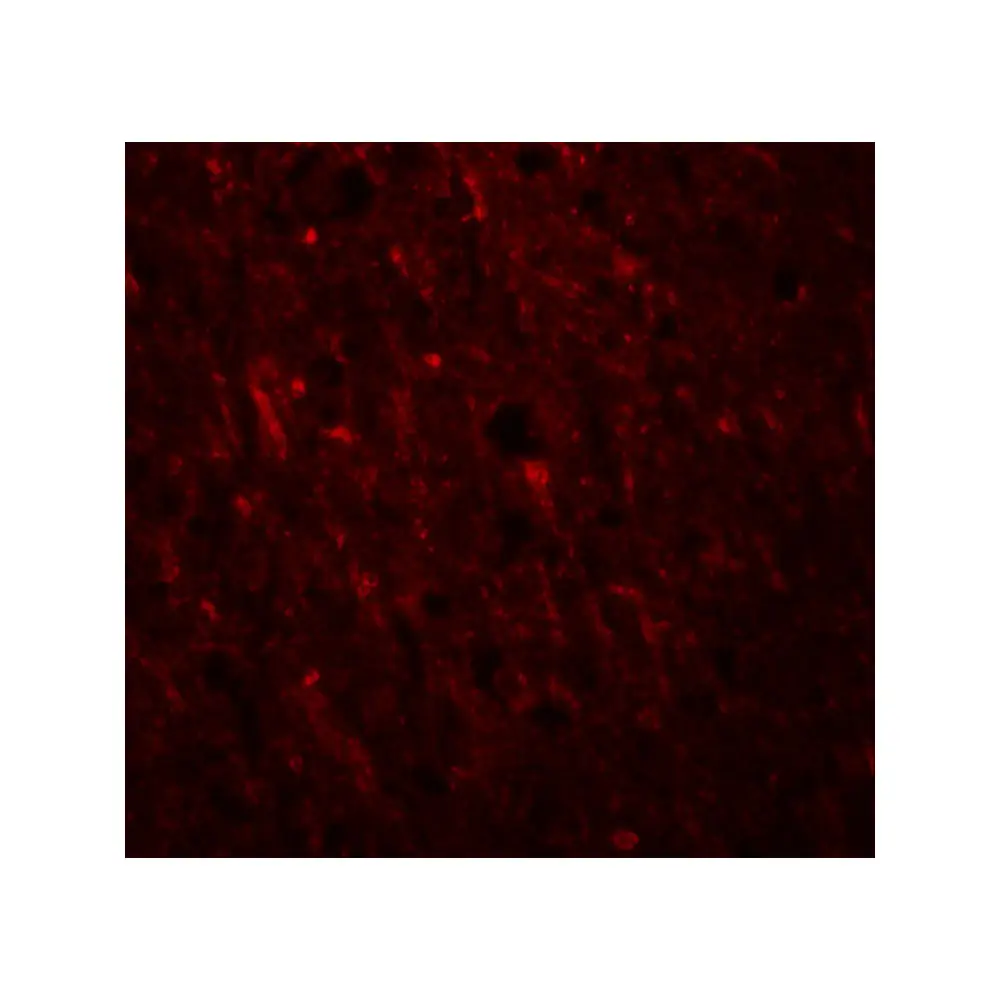 ProSci 5485_S PLEKHM2 Antibody, ProSci, 0.02 mg/Unit Tertiary Image