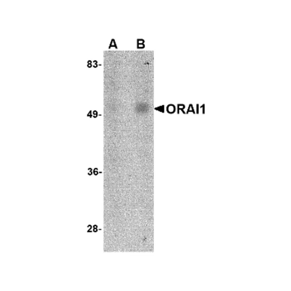 ProSci PM-5207 ORAI1 Antibody [6D11A11] , ProSci, 0.1 mg/Unit Primary Image