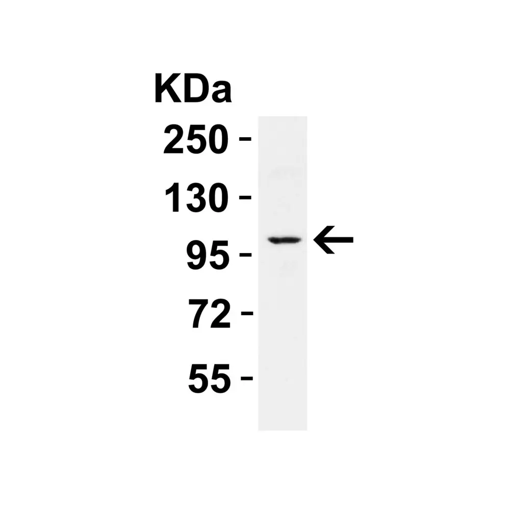 ProSci 7793_S PPARGC1A Antibody, ProSci, 0.02 mg/Unit Tertiary Image