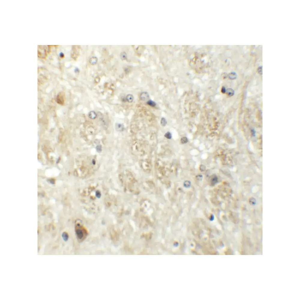 ProSci 6291_S PRR5 Antibody, ProSci, 0.02 mg/Unit Secondary Image