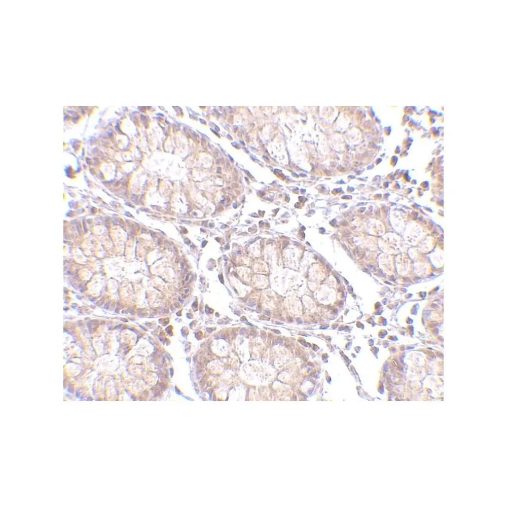 ProSci 4299_S PTK7 Antibody, ProSci, 0.02 mg/Unit Secondary Image