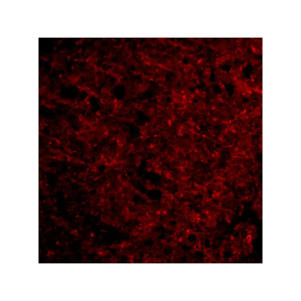 ProSci 4203 Presenilin1 Antibody, ProSci, 0.1 mg/Unit Tertiary Image