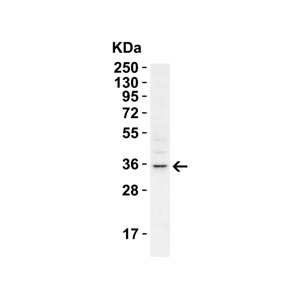 ProSci 5525 RHBDD1 Antibody, ProSci, 0.1 mg/Unit Primary Image