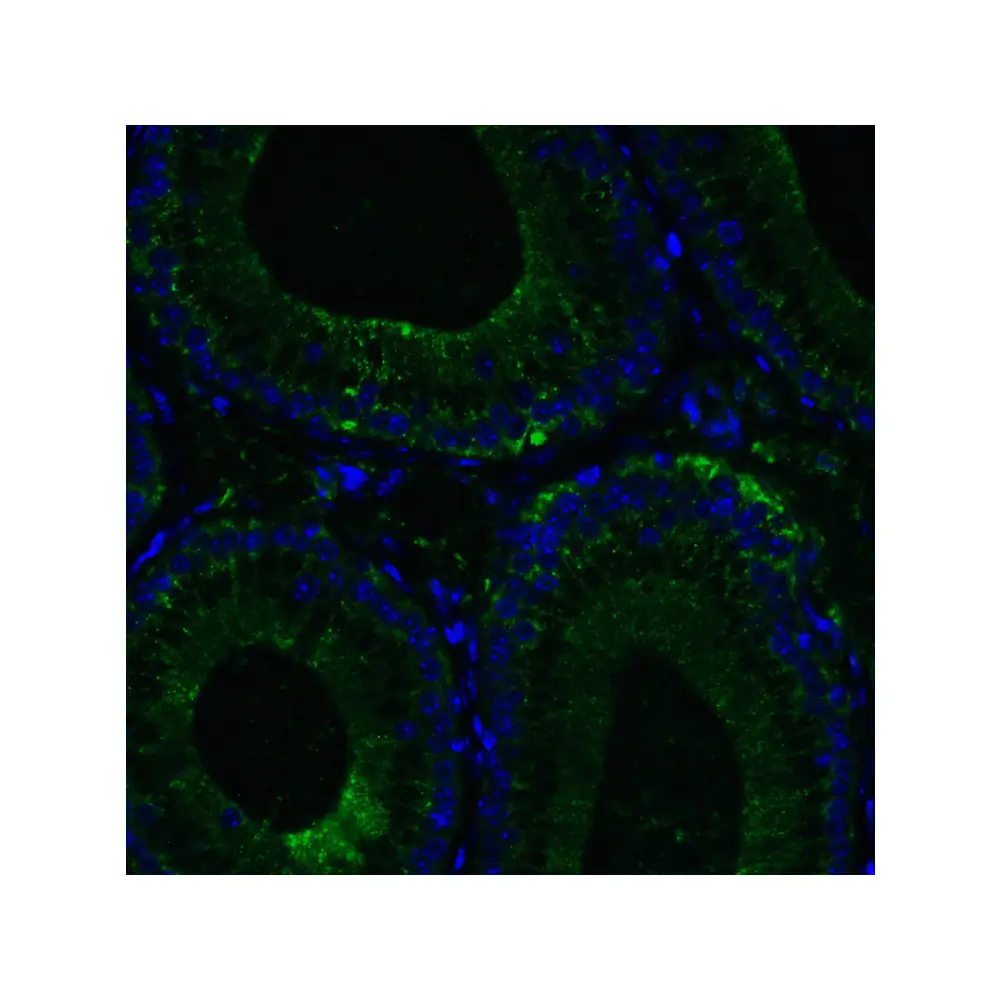 ProSci 3953_S RIG-1 Antibody, ProSci, 0.02 mg/Unit Senary Image