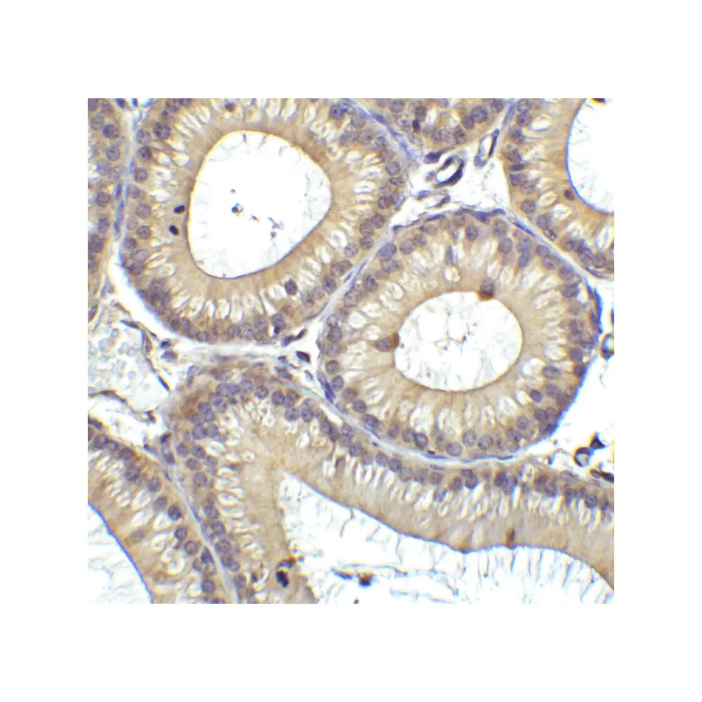 ProSci 3953_S RIG-1 Antibody, ProSci, 0.02 mg/Unit Secondary Image