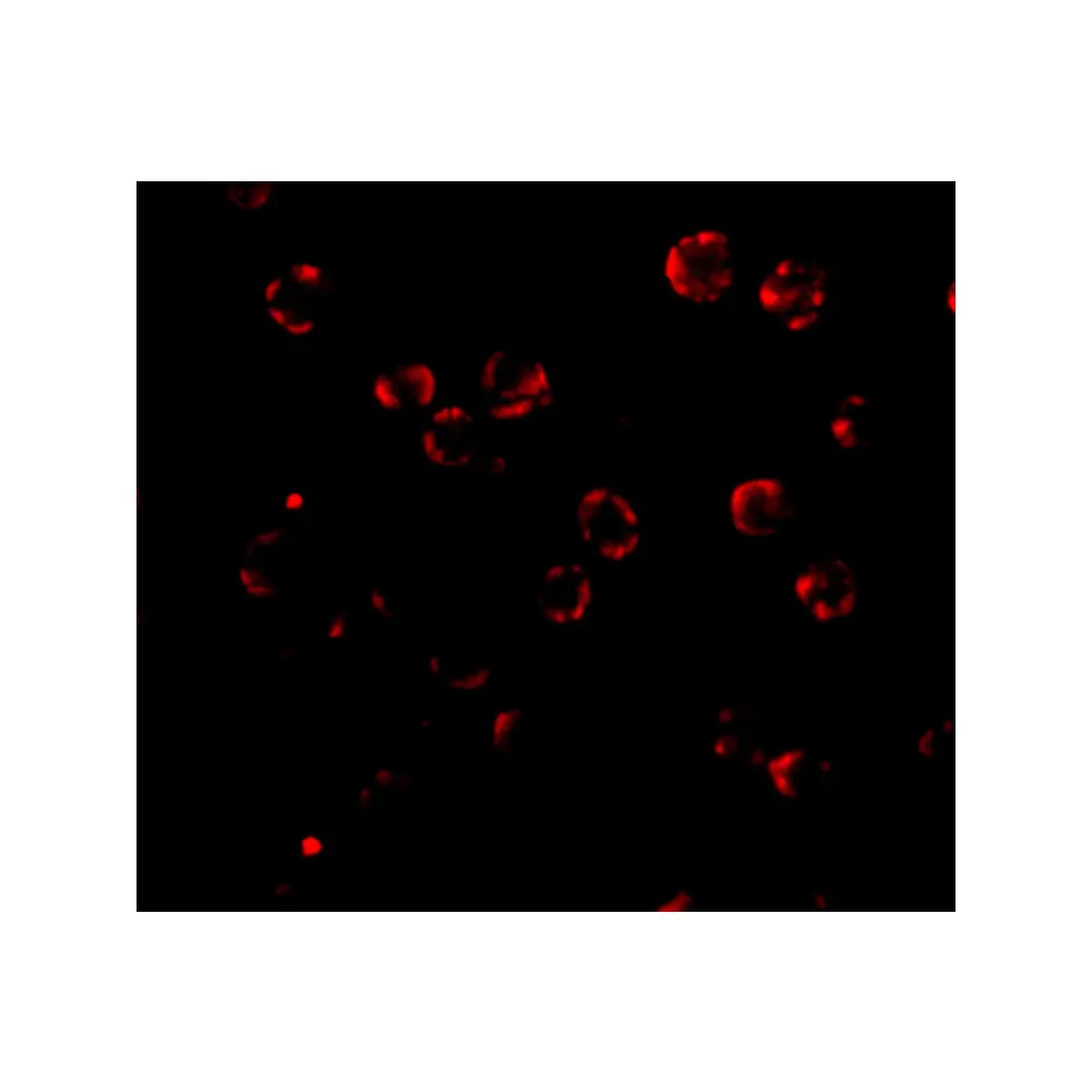 ProSci 4979 RNAse H2A Antibody, ProSci, 0.1 mg/Unit Tertiary Image