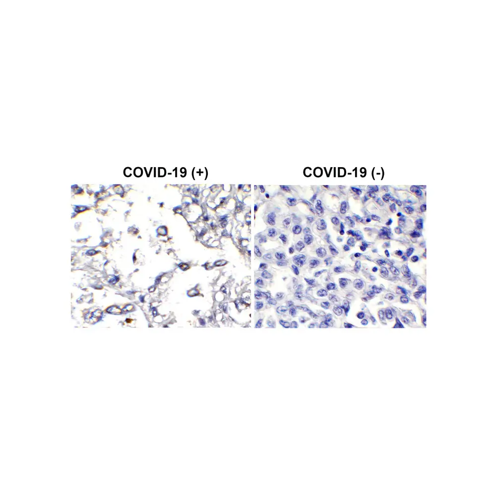 ProSci 9157-biotin SARS-CoV-2 (COVID-19) Membrane Antibody (biotin), ProSci, 0.1 mg/Unit Secondary Image