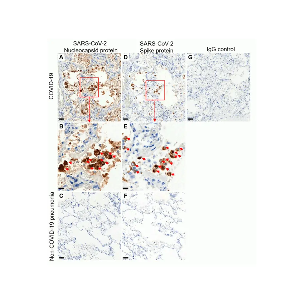 ProSci 9099_S SARS-CoV-2 (COVID-19) Nucleocapsid Antibody, ProSci, 0.02 mg/Unit Primary Image