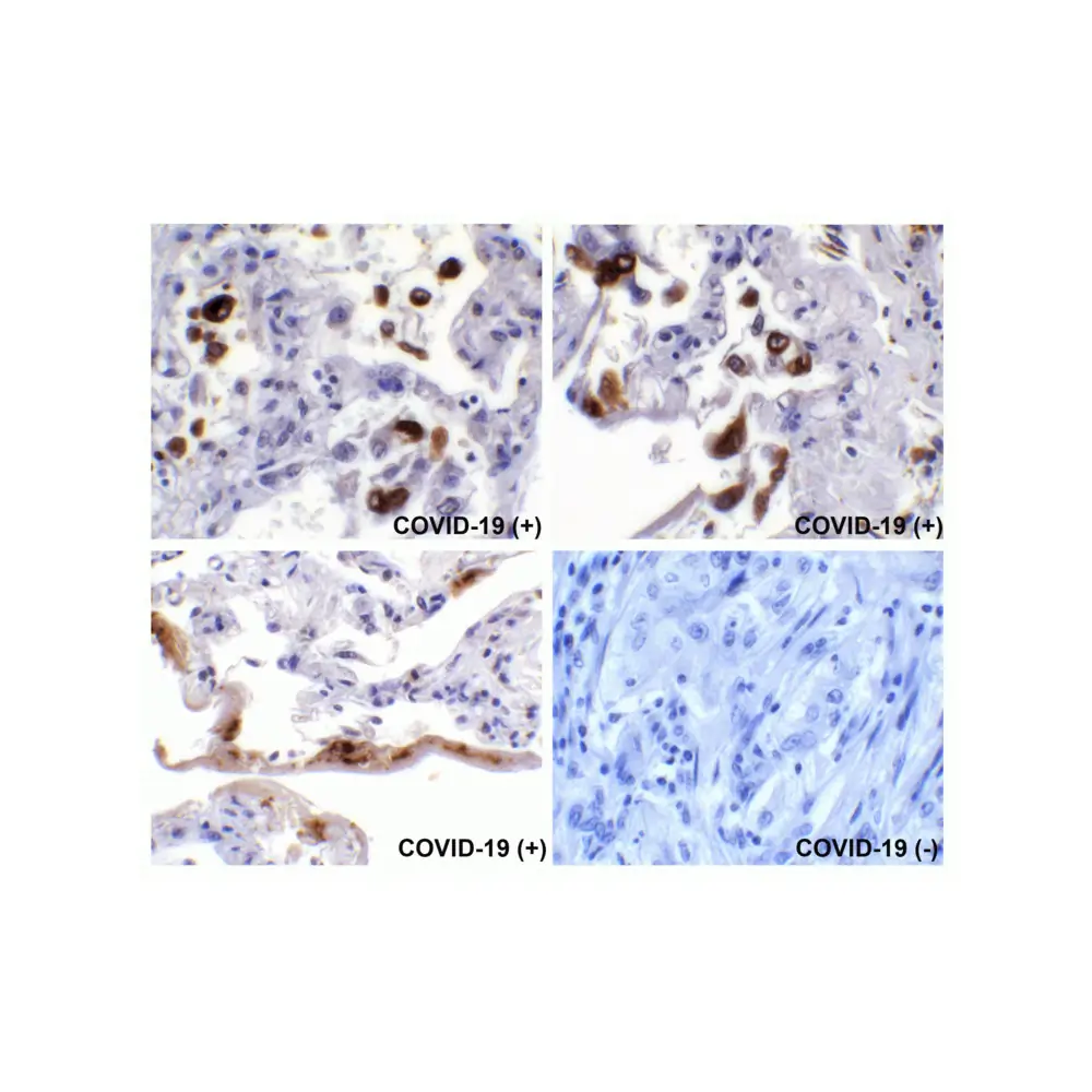 ProSci 3525 SARS-CoV-2 (COVID-19) Spike Antibody, ProSci, 0.1 mg/Unit Quaternary Image