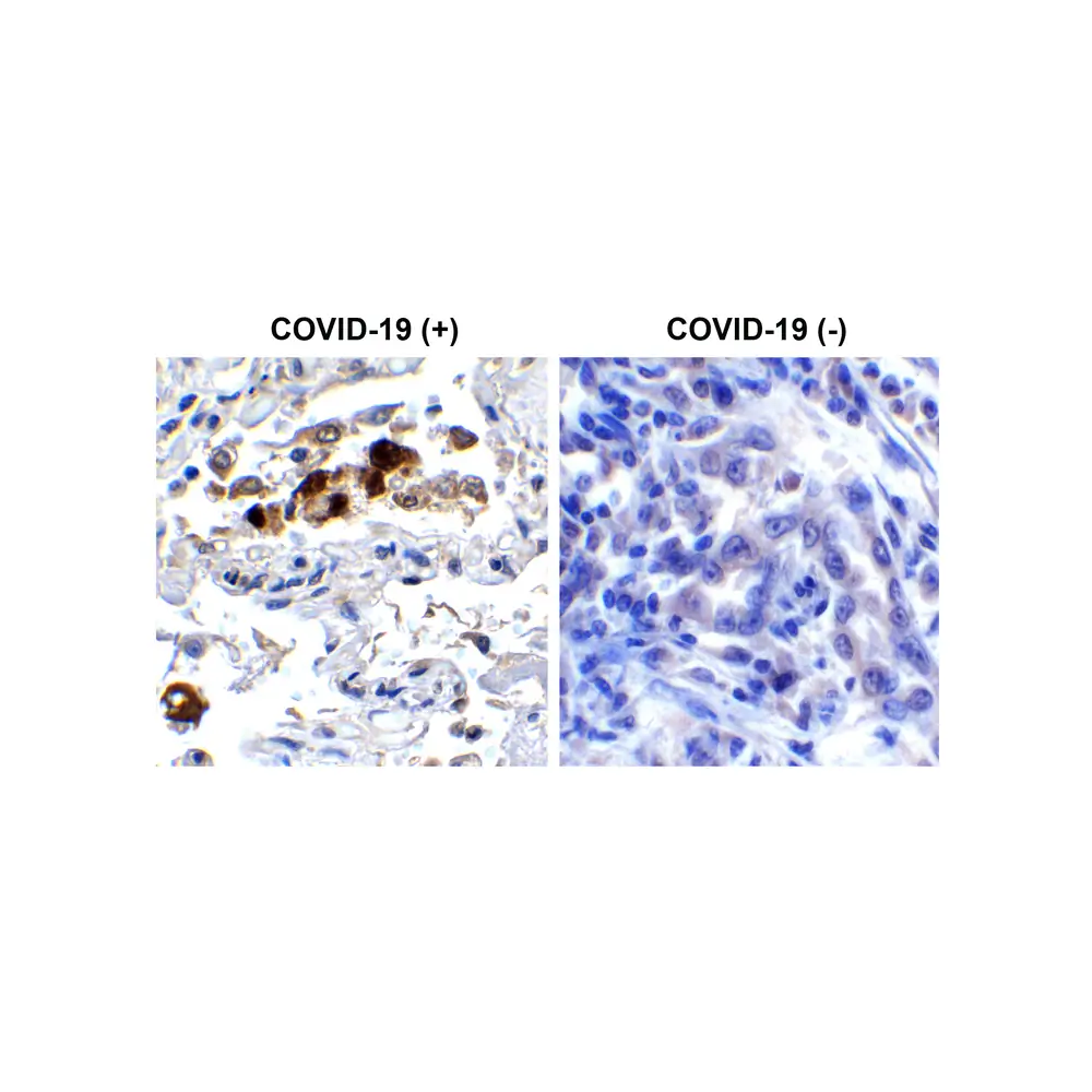 ProSci 9087 SARS-CoV-2 (COVID-19) Spike RBD Antibody, ProSci, 0.1 mg/Unit Secondary Image