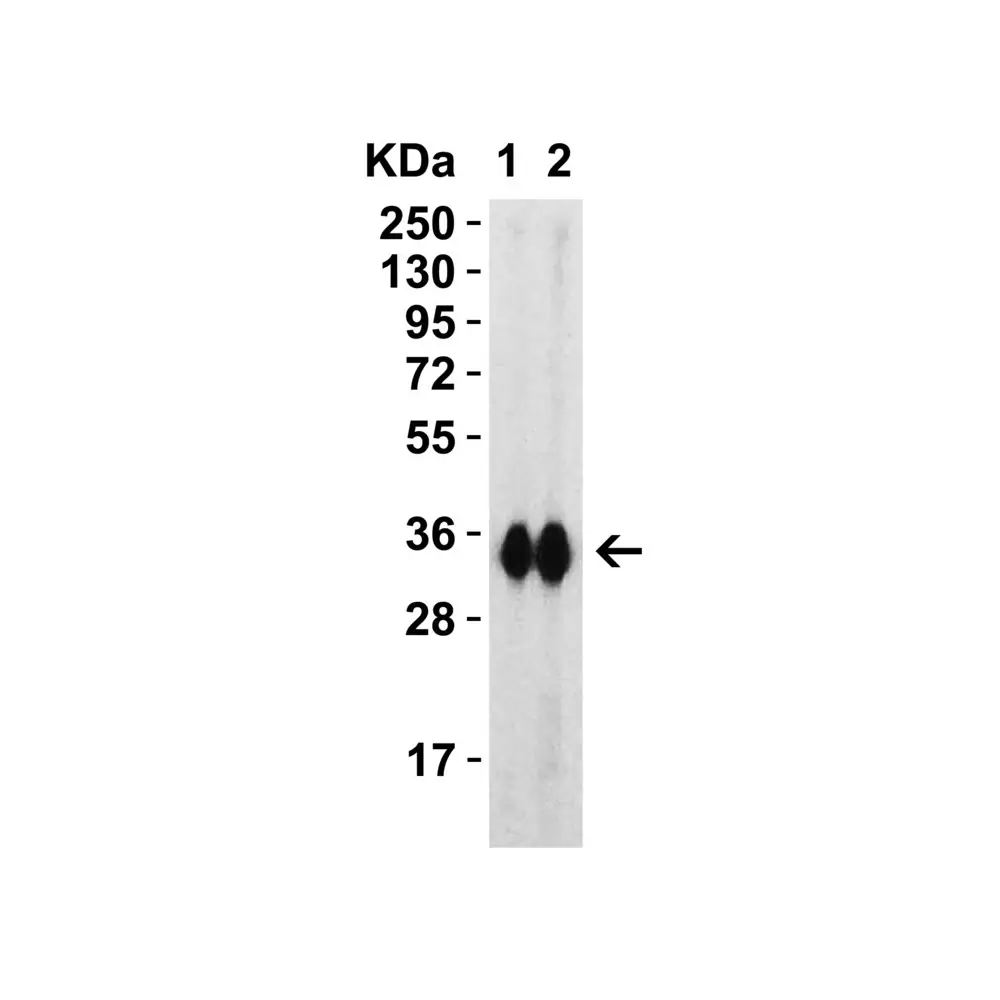 ProSci 9087 SARS-CoV-2 (COVID-19) Spike RBD Antibody, ProSci, 0.1 mg/Unit Tertiary Image