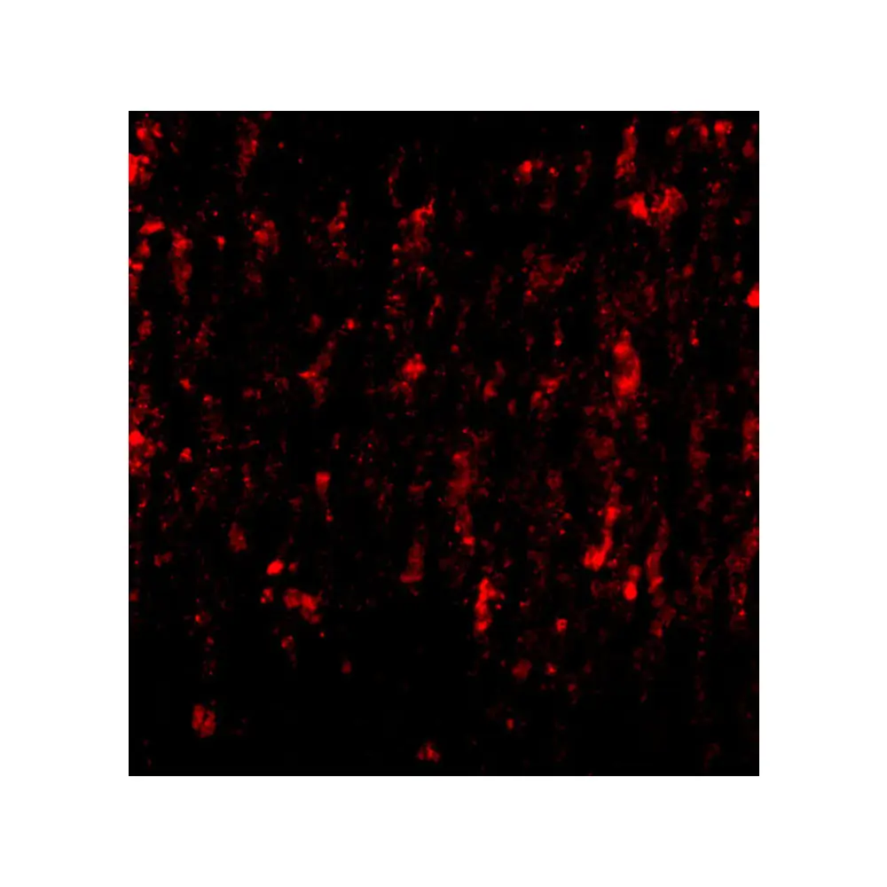 ProSci 4627 SATB2 Antibody, ProSci, 0.1 mg/Unit Tertiary Image