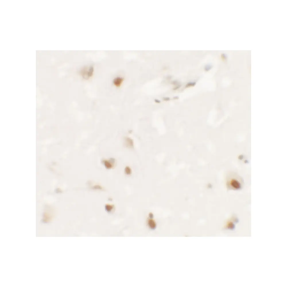 ProSci 6835 SHANK3 Antibody, ProSci, 0.1 mg/Unit Secondary Image