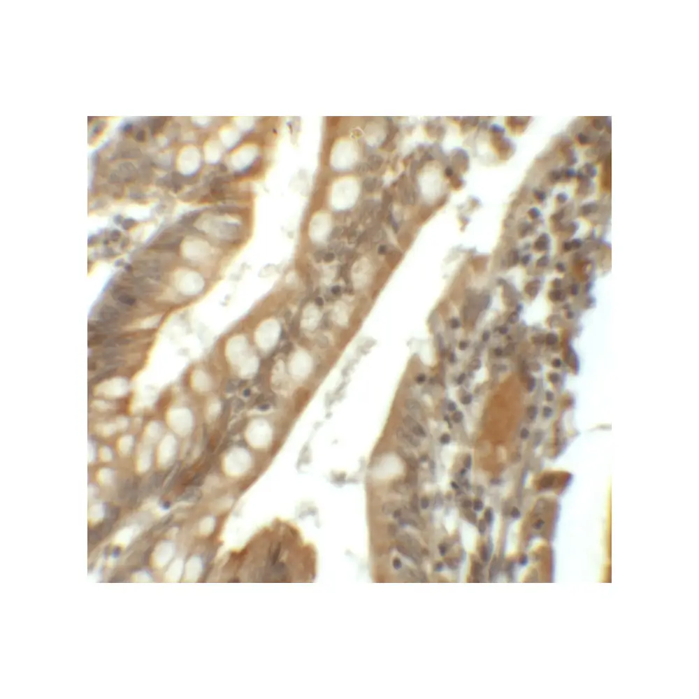 ProSci 6299_S SIK1 Antibody, ProSci, 0.02 mg/Unit Secondary Image