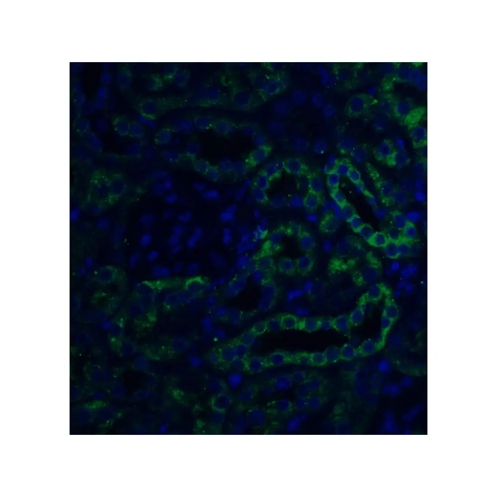 ProSci 4651_S Slc22A17 Antibody, ProSci, 0.02 mg/Unit Tertiary Image