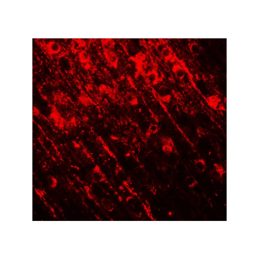 ProSci 7749 SMARCA4 Antibody, ProSci, 0.1 mg/Unit Tertiary Image