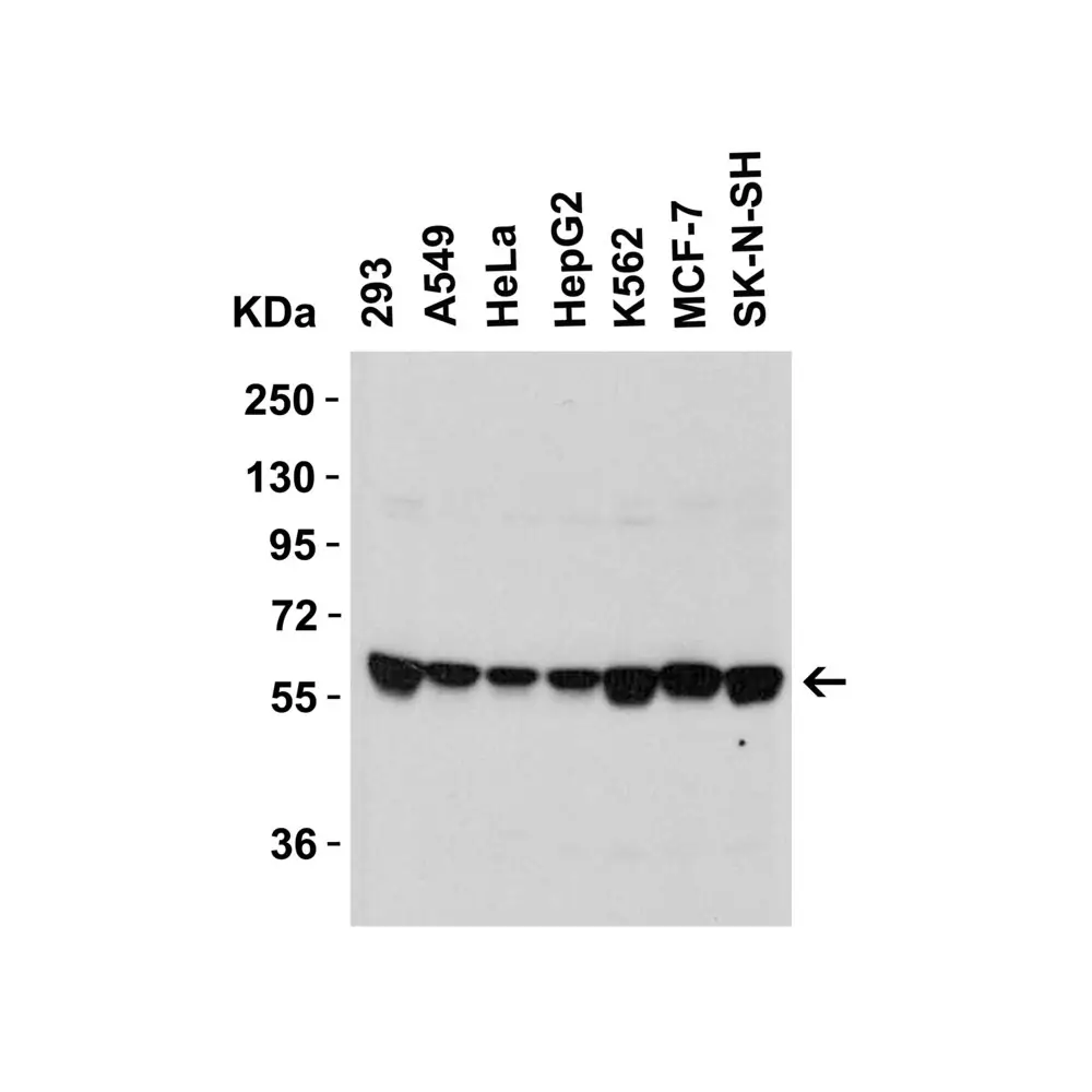 ProSci 6305 SPT2 Antibody, ProSci, 0.1 mg/Unit Secondary Image