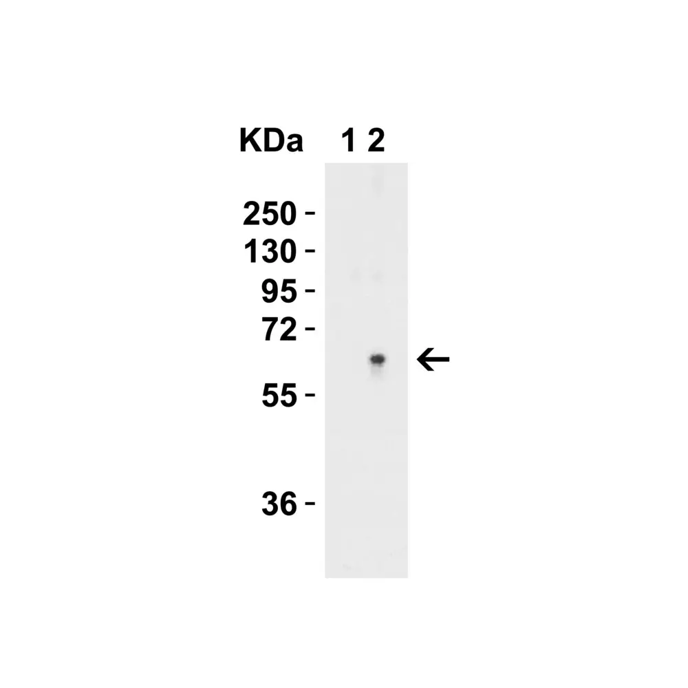 ProSci 6305 SPT2 Antibody, ProSci, 0.1 mg/Unit Quaternary Image