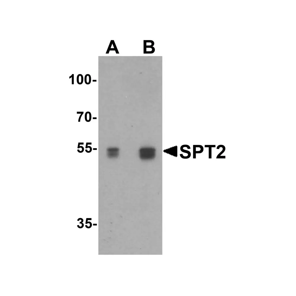 ProSci 6305 SPT2 Antibody, ProSci, 0.1 mg/Unit Tertiary Image