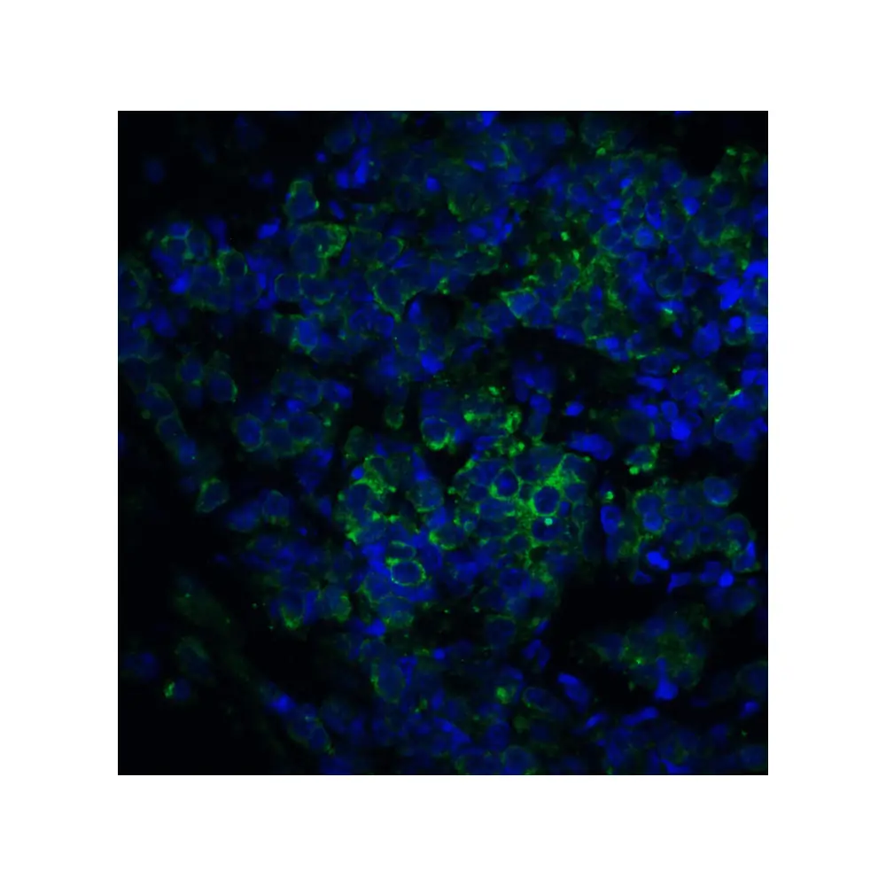 ProSci 3363 ST2 Antibody, ProSci, 0.1 mg/Unit Senary Image