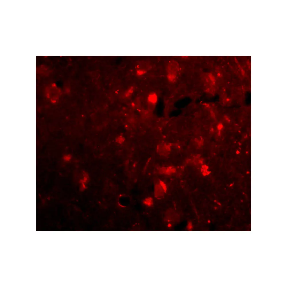 ProSci 4457_S Slitrk2 Antibody, ProSci, 0.02 mg/Unit Tertiary Image