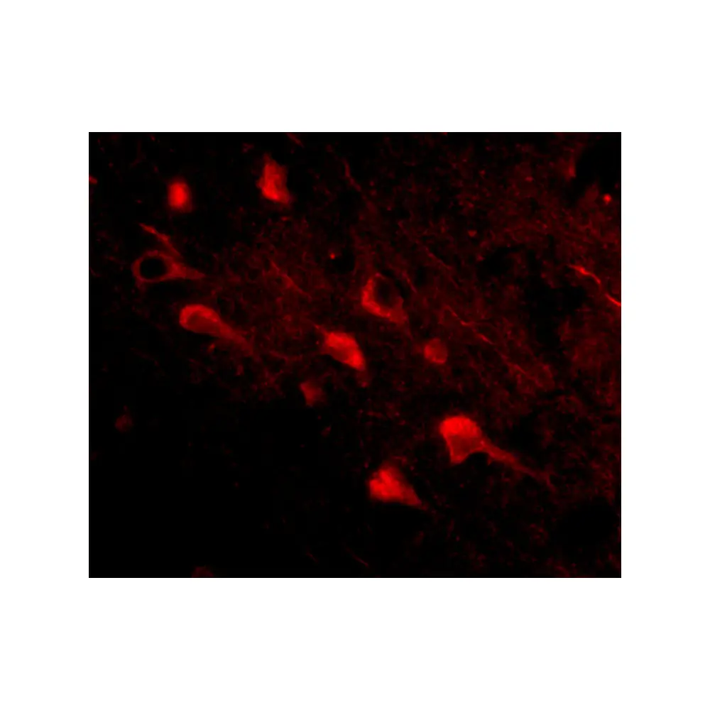 ProSci 4477_S Slitrk5 Antibody, ProSci, 0.02 mg/Unit Tertiary Image