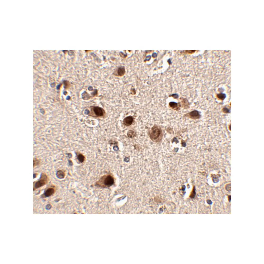 ProSci 4475 Slitrk5 Antibody, ProSci, 0.1 mg/Unit Secondary Image