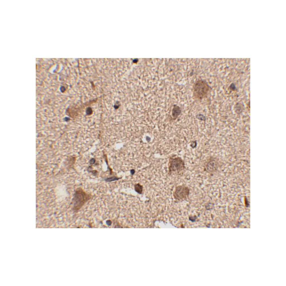 ProSci 4477_S Slitrk5 Antibody, ProSci, 0.02 mg/Unit Secondary Image