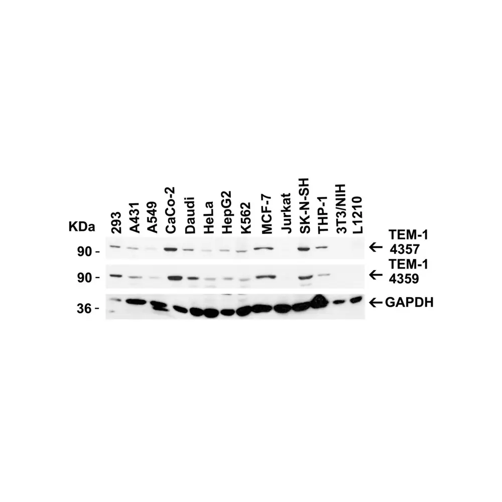 ProSci 4357 TEM1 Antibody, ProSci, 0.1 mg/Unit Secondary Image