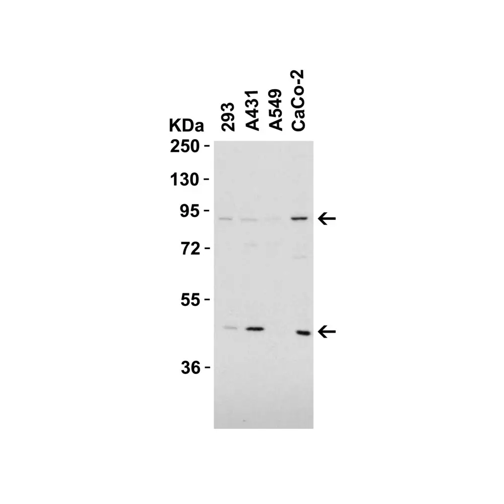 ProSci 4357 TEM1 Antibody, ProSci, 0.1 mg/Unit Tertiary Image